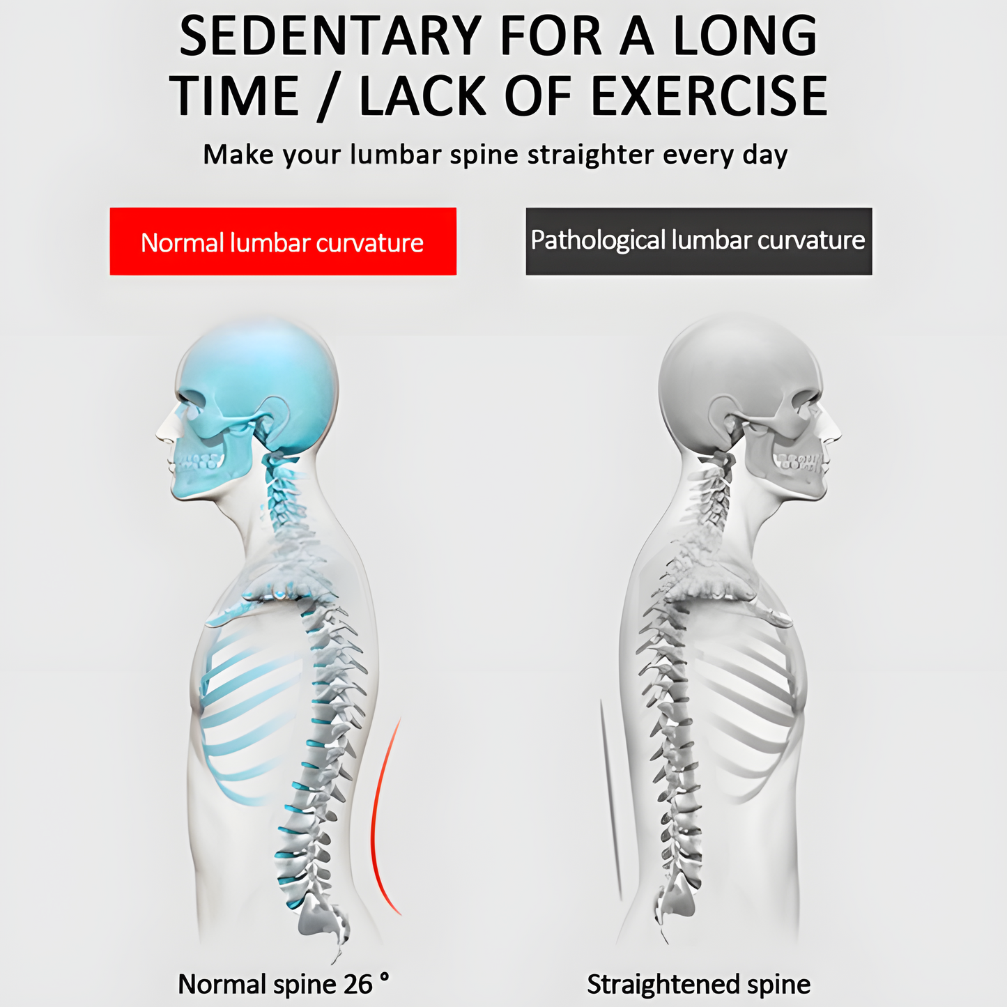 Posture Corrector
